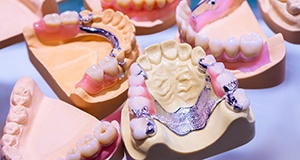 models of partial dentures