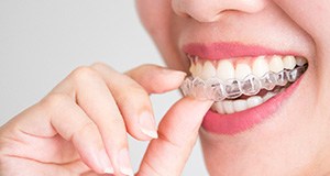 Nose-to-chin closeup of woman removing Invisalign from upper arch