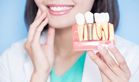 dentist holding a model of how dental implants work in Framingham 