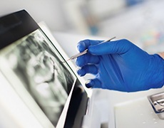 dentist examining a patient’s X-rays 