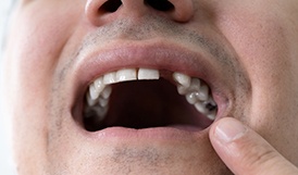 An older man talking to his dentist about dentures