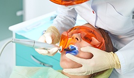 Teeth before and after tooth-colored fillings