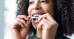 Woman with curly hair placing Invisalign over upper arch