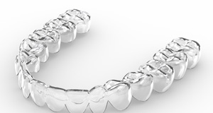 Closeup of a clear aligner on a white background