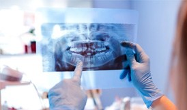 : Dentist with blue gloves looking at patient's X-ray