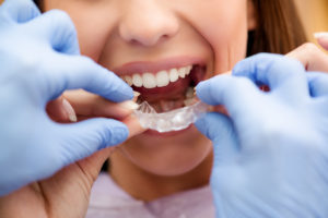 Woman putting in Invisalign in Framingham aligner