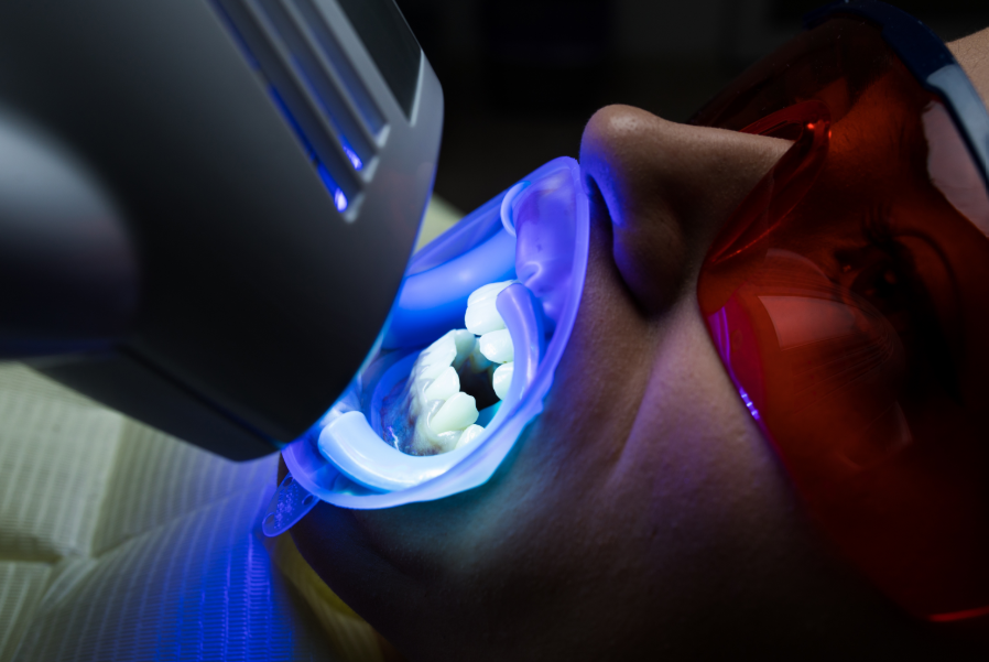 Patient undergoing whitening treatment